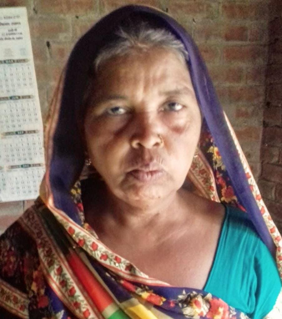 अंधविश्वास पड़ा भारी: सांप के काटने पर झाड़-फूंक कराते रहे, महिला की गई जान